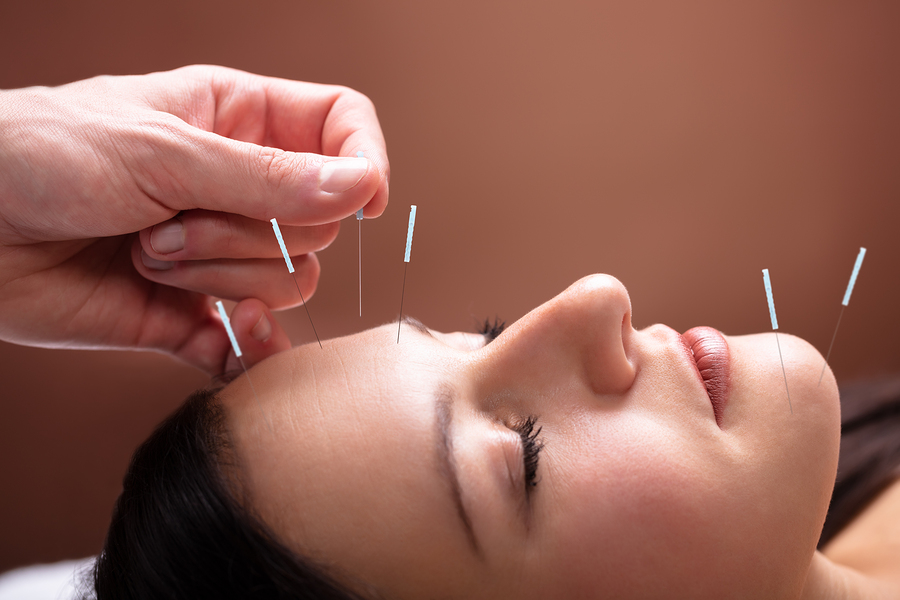 Cranial facial needling physiotherapist in Elwood