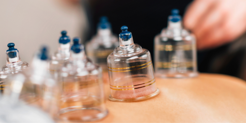  An Introduction to Cupping Therapy | How Often Can You Do Cupping?